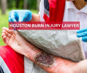 Houston Burn Injury Lawyer