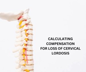 CALCULATING COMPENSATION FOR LOSS OF CERVICAL LORDOSIS